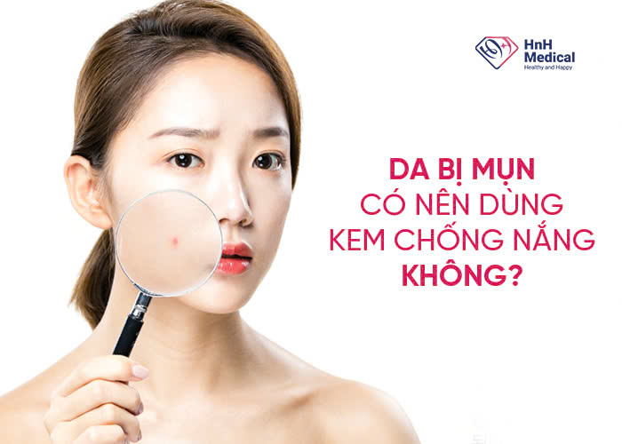 Da bị mụn có nên dùng kem chống nắng không?