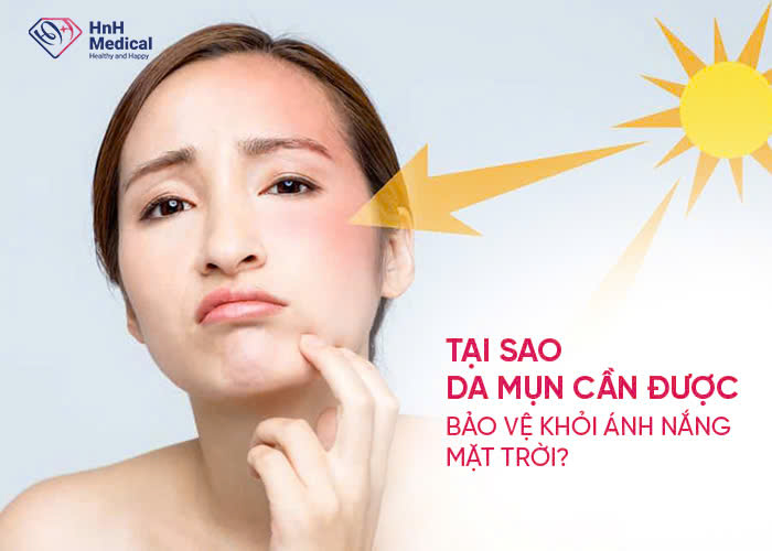 Tại sao da mụn cần được bảo vệ khỏi ánh nắng mặt trời?