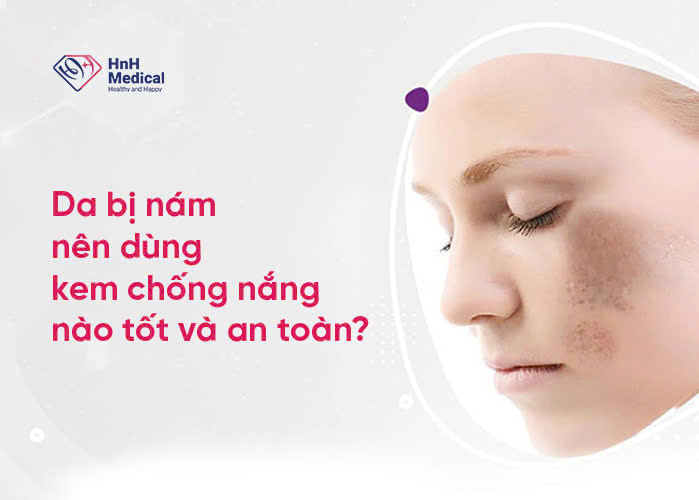 Da bị nám nên dùng kem chống nắng nào tốt và an toàn?