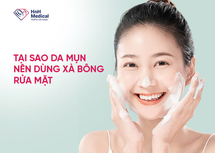 Tại sao da mụn nên dùng xà bông rửa mặt?