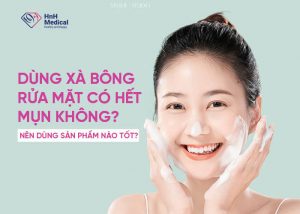 Dùng xà bông rửa mặt có hết mụn không? Nên dùng sản phẩm nào tốt?