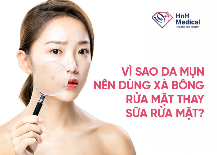 Vì sao da mụn nên dùng xà bông rửa mặt thay sữa rửa mặt?