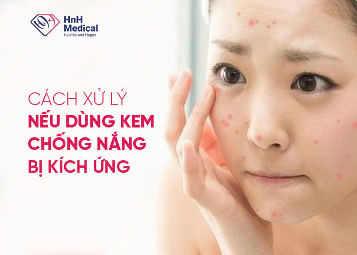 Cách xử lý nếu dùng kem chống nắng bị kích ứng